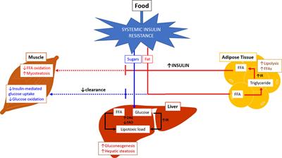 Gene-Environmental Interactions as Metabolic Drivers of Nonalcoholic Steatohepatitis